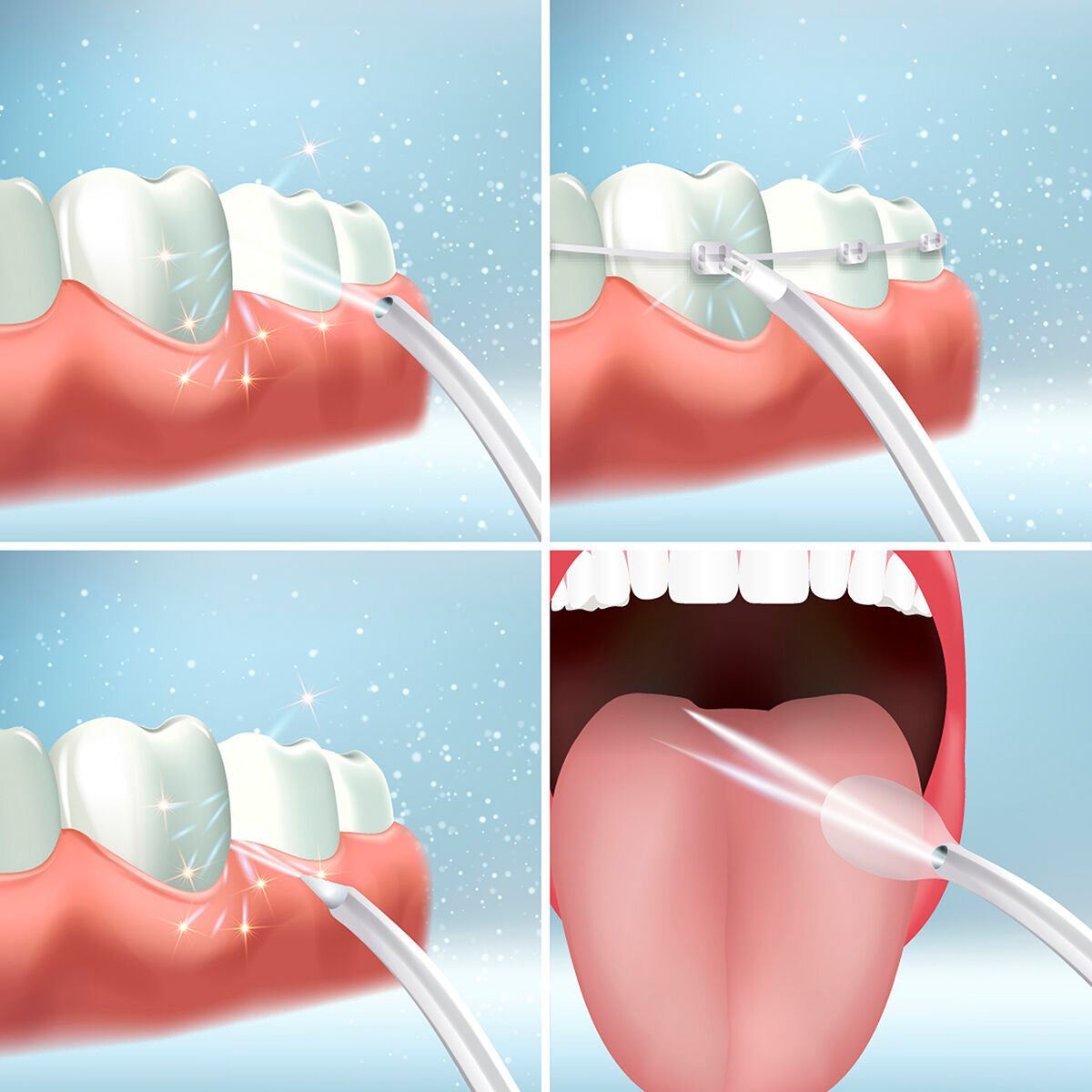 Denter Irrigador Oral Recargable InnovaGoods Portátil